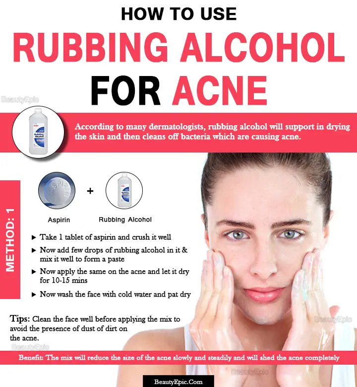 rubbing alcohol for acne